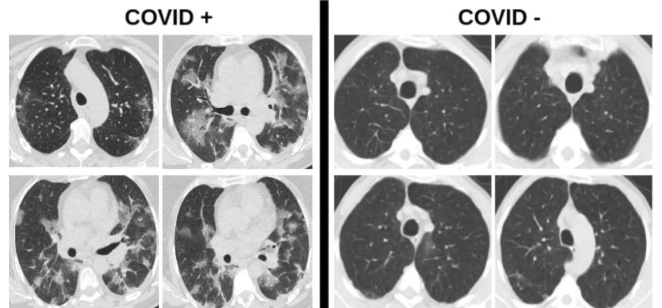 COVID-19 Publication